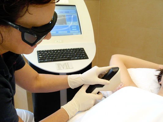 Intense Pulsed Light hair removal