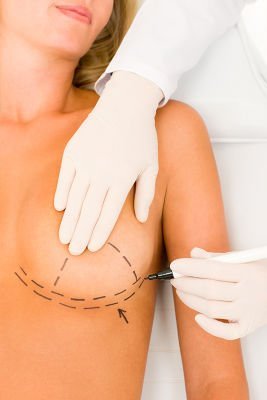 Mastopexy raises sagging breast 