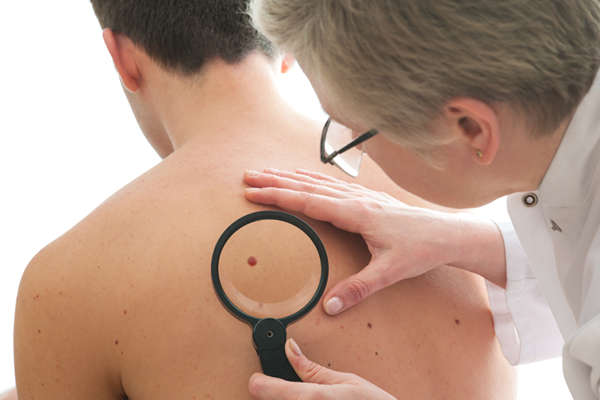 mosh surgery, specialised in excising skin cancer