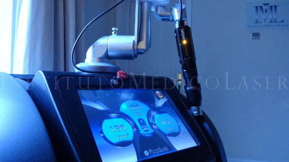 Picosure, picosecond laser for tattoo removal, available at IML