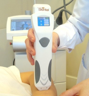 Skintel measures the pigmentation content in the skin before setting the laser hair removal parameters.