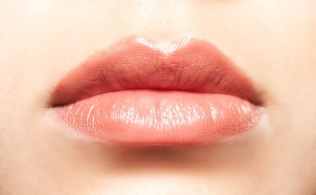 Lip Lift is aimed at lifting the upper lip